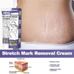 Skin Care Improves Elasticity Effective After Pregnancy Stretch Marks Removal Powerful Maternity Cream Nourishes Skin