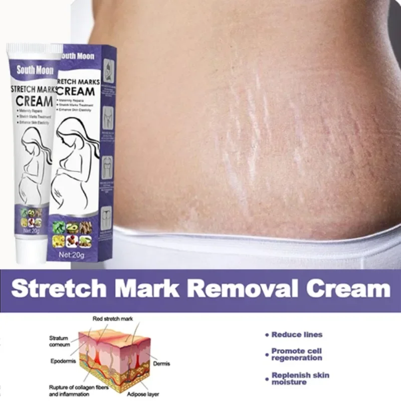 kf-S8365045b708043b4a9220127b12c74a1d Skin Care Improves Elasticity Effective After Pregnancy Stretch Marks Removal Powerful Maternity Cream Nourishes Skin - Imagine 1
